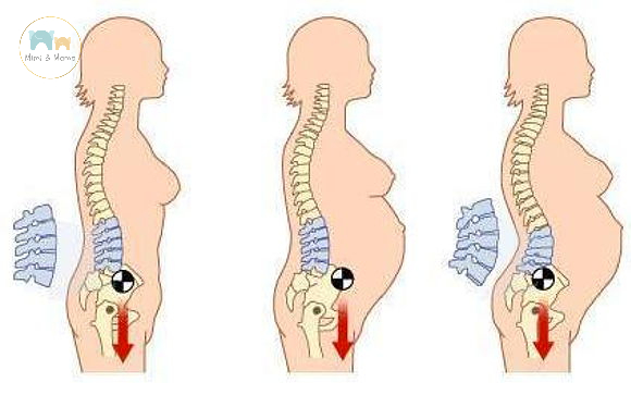 Sự thay đổi đường cong sinh lý là một trong những nguyên nhân khiến mẹ bầu đau lưng trong thai kỳ