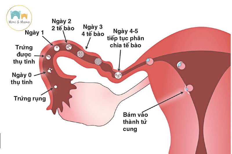 Sự làm tổ của thai cũng khiến mẹ đau bụng dưới lâm râm