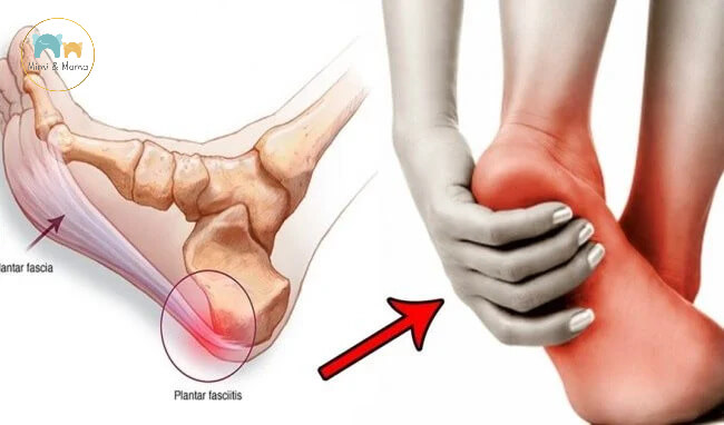 Bà bầu đau gót chân 3 tháng cuối phải làm sao?