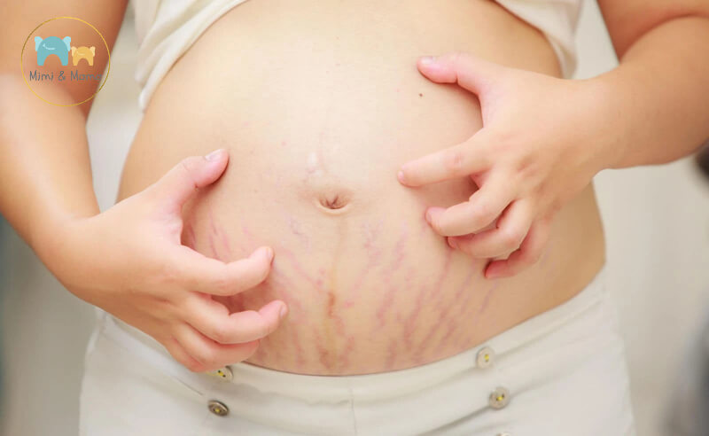 Mạch mẹ các mẹo dân gian trị ngứa cho bà bầu phổ biến