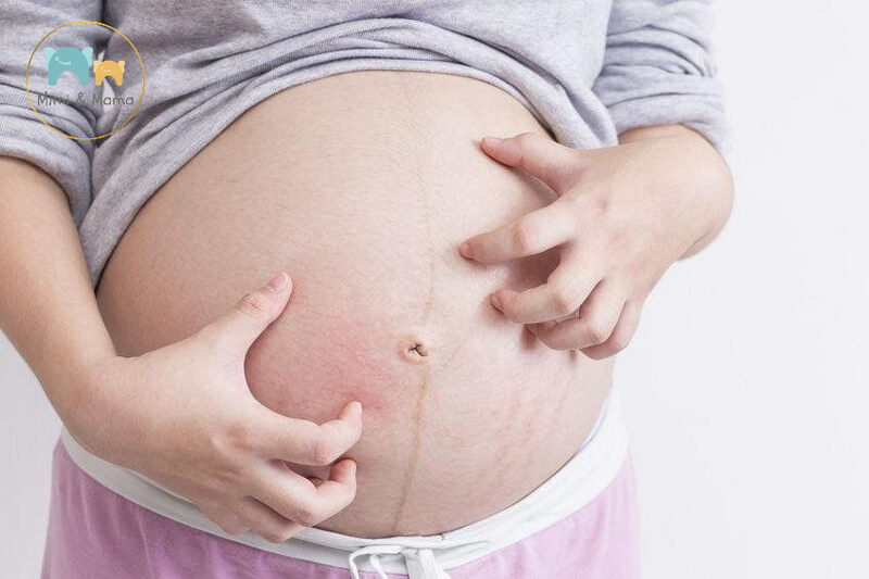 Giải đáp các thắc mắc thường gặp về tình trạng ngứa thai kỳ