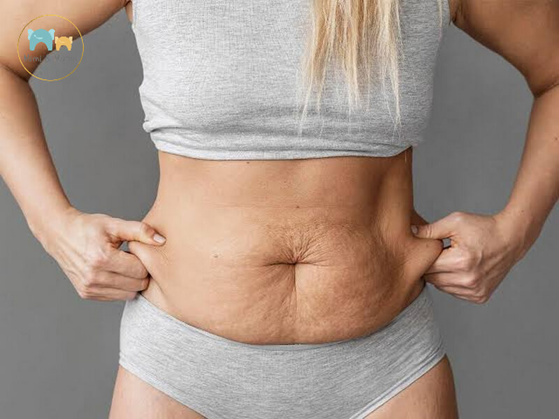 Thời điểm phù hợp để bắt đầu hành trình giảm mỡ bụng